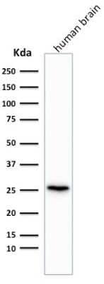 Western Blot: UCH-L1/PGP9.5 Antibody (rUCHL1/775) - Azide and BSA Free [NBP2-75775] - Western Blot Analysis of human brain tissue lysate using UCH-L1/PGP9.5 Antibody (rUCHL1/775)