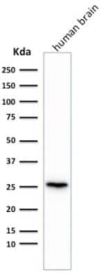 Western Blot: UCH-L1/PGP9.5 Antibody (rUCHL1/775) [NBP2-75773] - Western Blot Analysis of human brain tissue lysate using UCH-L1/PGP9.5 Antibody (rUCHL1/775)