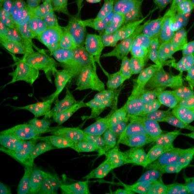 Immunocytochemistry/Immunofluorescence: UCH-L1/PGP9.5 Antibody [NB110-58874] - Analysis of SH-SY5Y cells stained with rabbit pAb to UCHL1, NB110-58874, dilution 1:1,000 in green, and costained with mouse mAb to fibrillarin, dilution 1:1,000 in red. Blue is DAPI staining of nuclear DNA. The UCHL1 antibody produces strong staining of the cellular cytoplasm of these cells which share many properties with neurons, while the fibrilarin antibody specifically labels nucleoli.