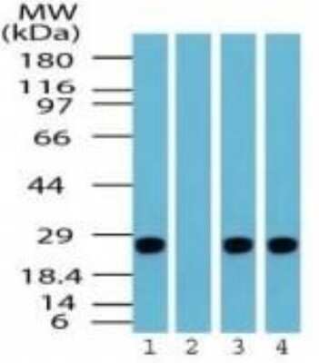 Western Blot: UCH-L1/PGP9.5 Antibody [NBP2-24719] - Analysis of UCH-L1/PGP9.5 in human brain lysate in the 1) absence and 2) presence of immunizing peptide, 3) mouse brain lysate and 4) rat brain lysate