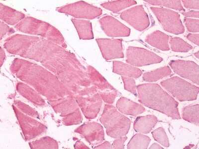 Immunohistochemistry-Paraffin: UCH-L3 Antibody [NB110-40472] - Analysis of human skeletal muscle.
