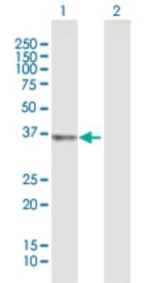 Western Blot: UCH37 Antibody [H00051377-B02P] - Analysis of UCHL5 expression in transfected 293T cell line by UCHL5 polyclonal antibody.  Lane 1: UCHL5 transfected lysate(35.86 KDa). Lane 2: Non-transfected lysate.