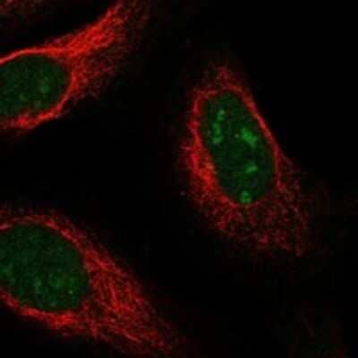 Immunocytochemistry/Immunofluorescence: UCK Antibody [NBP3-17453] - Staining of human cell line U-2 OS shows localization to nucleoplasm & nucleoli.