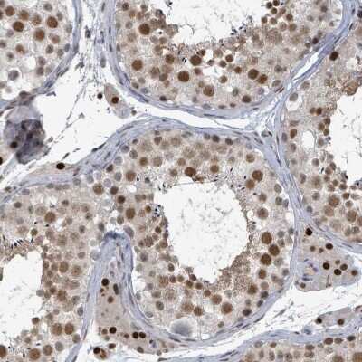 Immunohistochemistry-Paraffin: UCK Antibody [NBP2-47587] - Staining of human testis shows moderate to strong nuclear positivity in cells in seminiferous ducts.