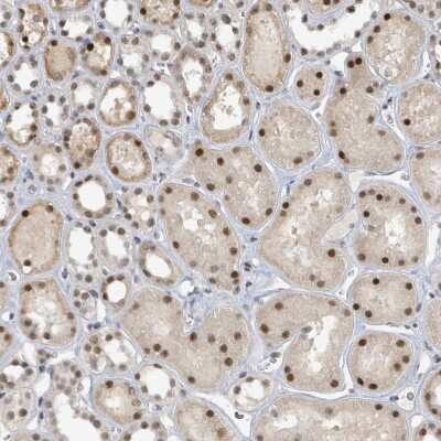 Immunohistochemistry-Paraffin: UCK Antibody [NBP2-47587] - Staining of human kidney shows strong nuclear and moderate cytoplasmic positivity in cells in tubules.