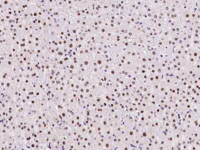 Immunohistochemistry-Paraffin: UCK Antibody [NBP2-98565] - Immunochemical staining of human UCK in human large intestine with rabbit polyclonal antibody at 1:500 dilution, formalin-fixed paraffin embedded sections.