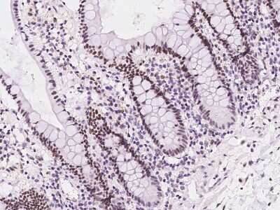 Immunohistochemistry-Paraffin: UCK Antibody [NBP2-98565] - Immunochemical staining of human UCK in human liver with rabbit polyclonal antibody at 1:500 dilution, formalin-fixed paraffin embedded sections.