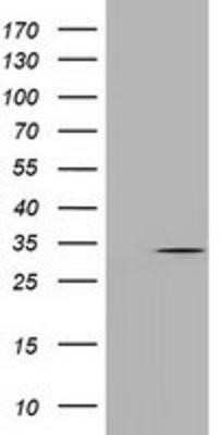 Western Blot: UCK Antibody (OTI1A12) - Azide and BSA Free [NBP2-74779] - HEK293T cells were transfected with the pCMV6-ENTRY control (Left lane) or pCMV6-ENTRY UCK (Right lane) cDNA for 48 hrs and lysed. Equivalent amounts of cell lysates (5 ug per lane) were separated by SDS-PAGE and immunoblotted with anti-UCK.