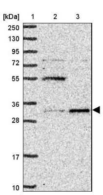 Western Blot UCK Antibody - BSA Free