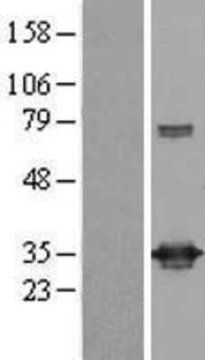 Western Blot UCK Overexpression Lysate