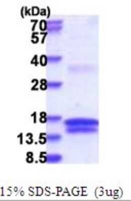 SDS-PAGE Recombinant Human UCK His Protein