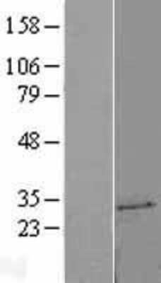 Western Blot: UCK2 Overexpression Lysate (Adult Normal) [NBL1-17580] Left-Empty vector transfected control cell lysate (HEK293 cell lysate); Right -Over-expression Lysate for UCK2.