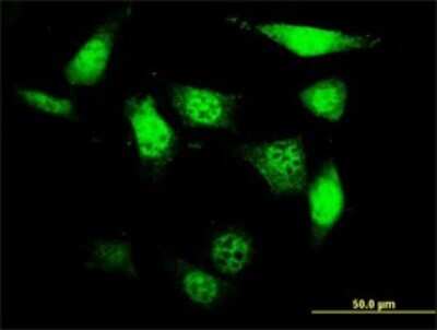 Immunocytochemistry/Immunofluorescence: UCKL1 Antibody (8D4) [H00054963-M01] - Analysis of monoclonal antibody to UCKL1 on NIH/3T3 cell. Antibody concentration 10 ug/ml.