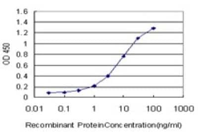 Sandwich ELISA: UCKL1 Antibody (8D4) [H00054963-M01] - Detection limit for recombinant GST tagged UCKL1 is approximately 0.3ng/ml as a capture antibody.