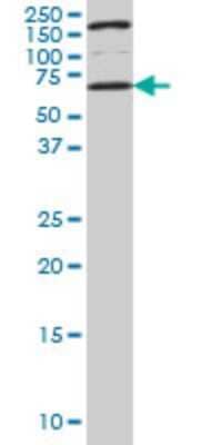 Western Blot: UCKL1 Antibody (8D4) [H00054963-M01] - UCKL1 monoclonal antibody (M01), clone 8D4 Analysis of UCKL1 expression in NIH/3T3.