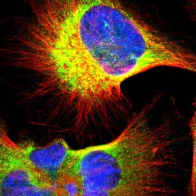 Immunocytochemistry/Immunofluorescence: UCKL1 Antibody [NBP1-83648] - Staining of human cell line U-251 MG shows localization to endoplasmic reticulum. Antibody staining is shown in green.