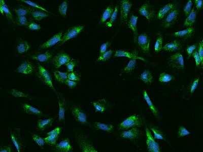 Immunocytochemistry/Immunofluorescence: UCKL1 Antibody [NBP2-98566] - Immunofluorescence staining of UCKL1 in U251MG cells. Cells were fixed with 4% PFA, permeabilzed with 0.1% Triton X-100 in PBS, blocked with 10% serum, and incubated with rabbit anti-Human UCKL1 polyclonal antibody (dilution ratio 1:200) at 4C overnight. Then cells were stained with the Alexa Fluor(R)488-conjugated Goat Anti-rabbit IgG secondary antibody (green) and counterstained with DAPI (blue).Positive staining was localized to Cytoplasm.