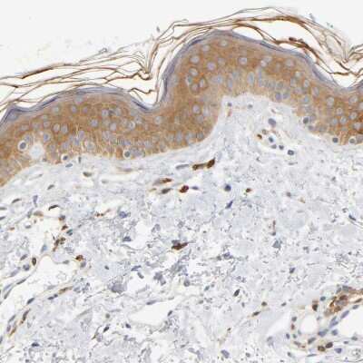Immunohistochemistry-Paraffin: UCKL1 Antibody [NBP1-83649] - Staining of human skin shows weak  cytoplasmic positivity in squamous epithelial cells.