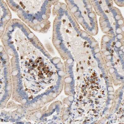 Immunohistochemistry-Paraffin: UCKL1 Antibody [NBP1-83649] - Staining of human small intestine shows moderate cytoplasmic positivity in lymphoid cells.