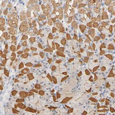 Immunohistochemistry-Paraffin: UCKL1 Antibody [NBP1-83649] - Staining of human stomach shows moderate cytoplasmic positivity in parietal cells.