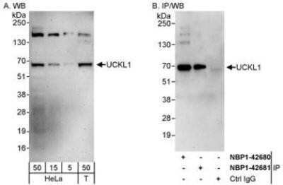 Western Blot: UCKL1 Antibody [NBP1-42680] - Whole cell lysate from HeLa (5, 15 and 50 mcg for WB; 1 mg for IP, 20% of IP loaded) and 293T (T; 50 mcg) cells.  Antibodies: Affinity purified rabbit anti-UCKL1 antibody used for WB at 0.04 mcg/ml (A) and 1 mcg/ml (B) and used for IP at 3 mcg/mg lysate.  UCKL1 was also immunoprecipitated by rabbit anti-UCKL1 antibody NBP1-42681, which recognizes a downstream epitope.
