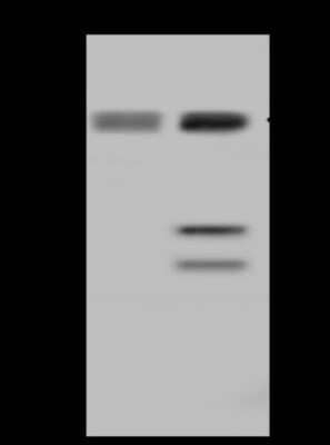 Western Blot: UCKL1 Antibody [NBP2-98566] - Anti-UCKL1 rabbit polyclonal antibody at 1:500 dilution. Lane A: 293T Whole Cell Lysate Lane B: HeLa Whole Cell Lysate Lysates/proteins at 30 ug per lane. Secondary Goat Anti-Rabbit IgG (H+L)/HRP at 1/10000 dilution. Developed using the ECL technique. Performed under reducing conditions. Predicted band size: 61 kDa. Observed band size: 61 kDa (We are unsure as to the identity of these extra bands).