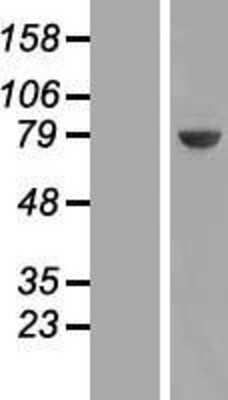 Western Blot: UCKL1 Overexpression Lysate (Adult Normal) [NBP2-06875] Left-Empty vector transfected control cell lysate (HEK293 cell lysate); Right -Over-expression Lysate for UCKL1.