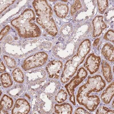 Immunohistochemistry-Paraffin: UCMA Antibody [NBP2-33469] - Staining of human kidney shows strong cytoplasmic and nucleolar positivity in cells in tubules.