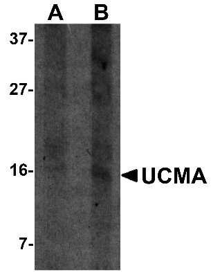 Western Blot: UCMA Antibody [NBP1-76321] - SW1353 cell lysate with UCMA antibody at (A) 2.5 and (B) 5 ug/ml.