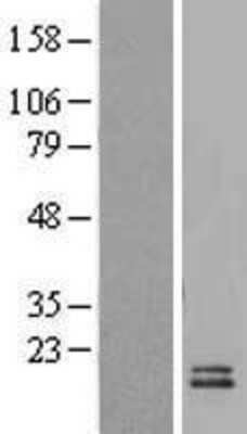 Western Blot: UCMA Overexpression Lysate (Adult Normal) [NBL1-08078] Left-Empty vector transfected control cell lysate (HEK293 cell lysate); Right -Over-expression Lysate for UCMA.