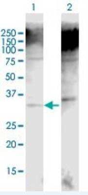 Western Blot: UCP2 Antibody [H00007351-B01P] - Expression in transfected 293T cell line. Lane 1: UCP2 transfected lysate(34.1 KDa). Lane 2: Non-transfected lysate.