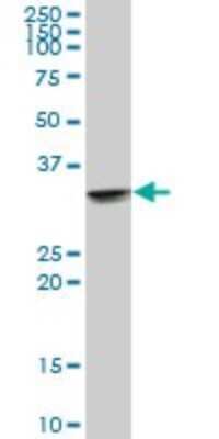 Western Blot: UCP2 Antibody [H00007351-B01P] - Analysis of UCP2 expression in rat brain.