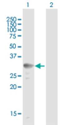 Western Blot: UCP2 Antibody [H00007351-B01P] - Analysis of UCP2 expression in transfected 293T cell line by UCP2 polyclonal antibody.  Lane 1: UCP2 transfected lysate(34.1 KDa). Lane 2: Non-transfected lysate.