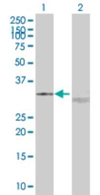 Western Blot: UCP2 Antibody [H00007351-B02P] - Analysis of UCP2 expression in transfected 293T cell line by UCP2 polyclonal antibody.  Lane 1: UCP2 transfected lysate(33.99 KDa). Lane 2: Non-transfected lysate.