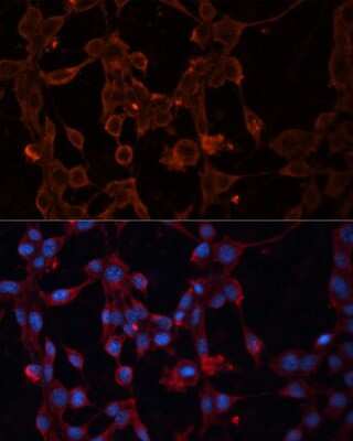 Immunocytochemistry/Immunofluorescence: UCP4 Antibody [NBP2-94702] - Analysis of NIH/3T3 cells using UCP4 at dilution of 1:100. Blue: DAPI for nuclear staining.