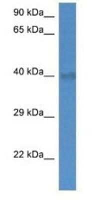 Western Blot: UCP4 Antibody [NBP1-80525] - Mouse Brain Lysate 1ug/ml Gel Concentration 12%