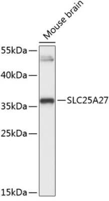 Western Blot: UCP4 Antibody [NBP2-94702] - Analysis of extracts of mouse brain, using UCP4 at 1:3000 dilution.Secondary antibody: HRP Goat Anti-Rabbit IgG (H+L) at 1:10000 dilution.Lysates/proteins: 25ug per lane.Blocking buffer: 3% nonfat dry milk in TBST.Detection: ECL Basic Kit .Exposure time: