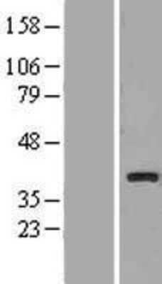 Western Blot: UCP4 Overexpression Lysate (Adult Normal) [NBP2-10579] Left-Empty vector transfected control cell lysate (HEK293 cell lysate); Right -Over-expression Lysate for UCP4.