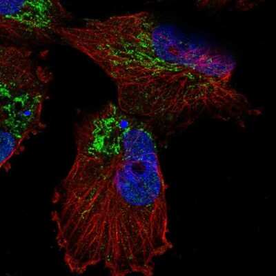 Immunocytochemistry/Immunofluorescence: UCP5 Antibody [NBP2-56930] - Staining of human cell line U-251 MG shows localization to mitochondria.