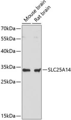 Western Blot: UCP5 Antibody [NBP2-94631] - Analysis of extracts of various cell lines, using UCP5 at 1:3000 dilution. Secondary antibody: HRP Goat Anti-Rabbit IgG (H+L) at 1:10000 dilution. Lysates/proteins: 25ug per lane. Blocking buffer: 3% nonfat dry milk in TBST. Detection: ECL Basic Kit . Exposure time: 90s.