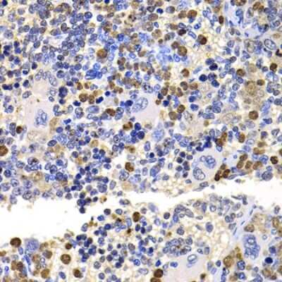 Immunohistochemistry-Paraffin: UEV2 Antibody [NBP2-95241] - Paraffin-embedded rat spleen using UEV2 .