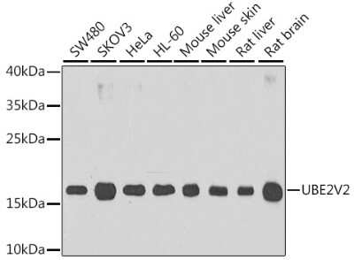 Western Blot: UEV2 Antibody [NBP2-95241] - Analysis of extracts of various cell lines, using UEV2 at 1:1000 dilution. Secondary antibody: HRP Goat Anti-Rabbit IgG (H+L) at 1:10000 dilution. Lysates/proteins: 25ug per lane. Blocking buffer: 3% nonfat dry milk in TBST. Detection: ECL Basic Kit . Exposure time: 90s.