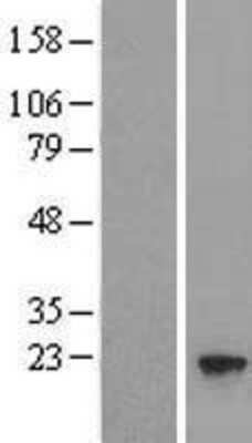 Western Blot: UFC1 Overexpression Lysate (Adult Normal) [NBL1-17586] Left-Empty vector transfected control cell lysate (HEK293 cell lysate); Right -Over-expression Lysate for UFC1.