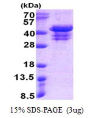 SDS-PAGE Recombinant Human UFD1L His Protein