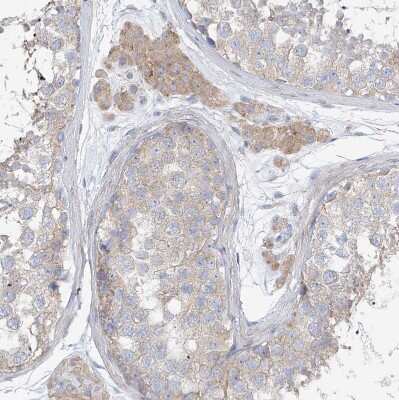 Immunohistochemistry-Paraffin: UFL1 Antibody [NBP1-90691] - Staining of human testis shows weak to moderate cytoplasmic positivity in Leydig cells.