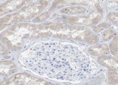Immunohistochemistry-Paraffin: UFL1 Antibody [NBP1-90691] - Staining of human kidney shows very weak cytoplasmic postivity in cells in tubules.