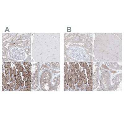 Immunohistochemistry-Paraffin: UFL1 Antibody [NBP1-90692] - Staining of human kidney, skeletal muscle, stomach and testis using Anti-UFL1 antibody NBP1-90692 (A) shows similar protein distribution across tissues to independent antibody NBP1-90691 (B).