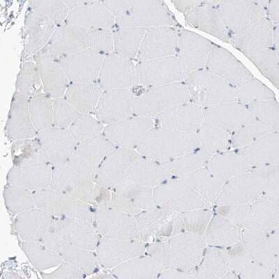 Immunohistochemistry-Paraffin: UFL1 Antibody [NBP1-90692] - Staining of human skeletal muscle shows no positivity in myocytes as expected.