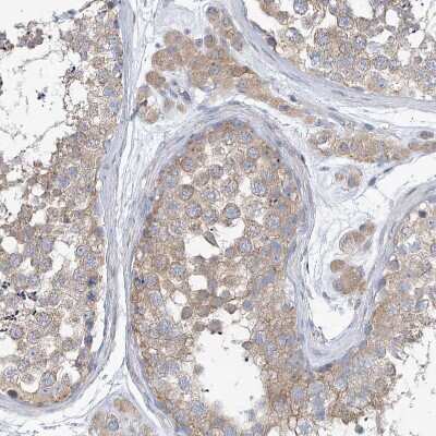 Immunohistochemistry-Paraffin: UFL1 Antibody [NBP1-90692] - Staining of human testis shows weak to moderate cytoplasmic positivity in Leydig cells and cells in seminifereus ducts.