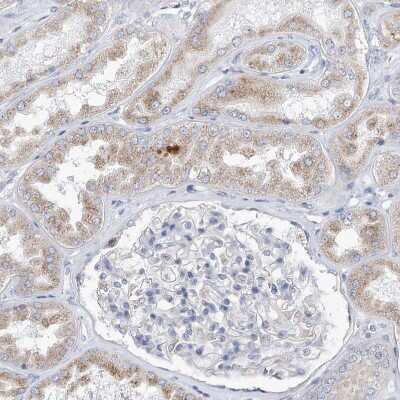 Immunohistochemistry-Paraffin: UFL1 Antibody [NBP1-90692] - Staining of human kidney shows very weak cytoplasmic positivity in cells in tubules.